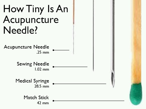 Acupuncture-Needles